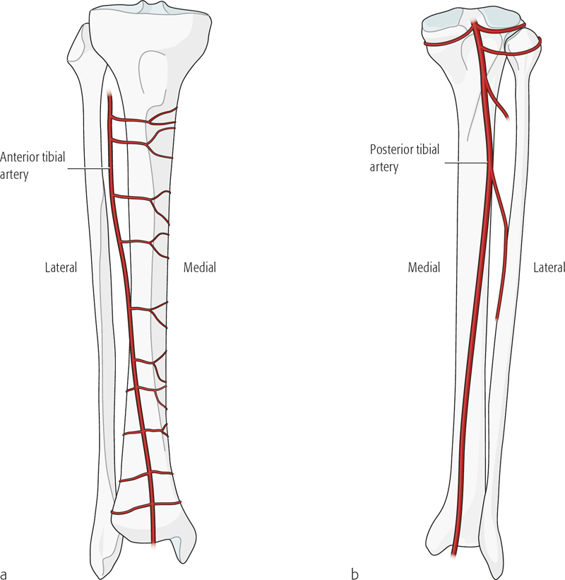 Tibia And Fibula, Shaft—introduction | Musculoskeletal Key