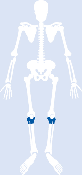 Tibia And Fibula, Proximal | Musculoskeletal Key