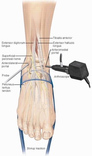 Ankle And Foot | Musculoskeletal Key