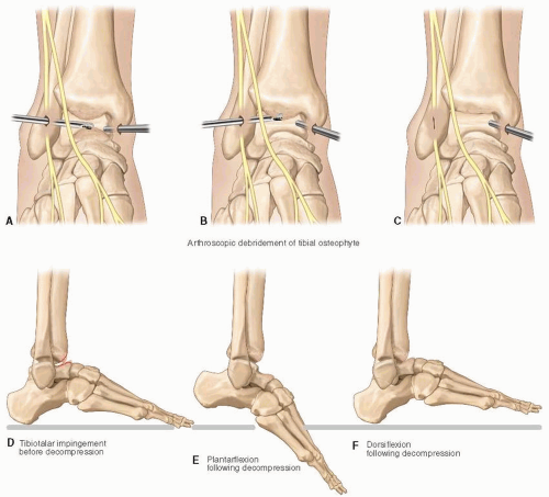 Ankle And Foot | Musculoskeletal Key