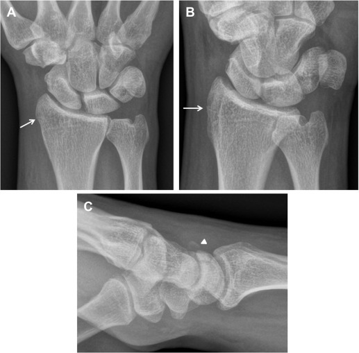 Imaging Of The Hand And Wrist | Musculoskeletal Key