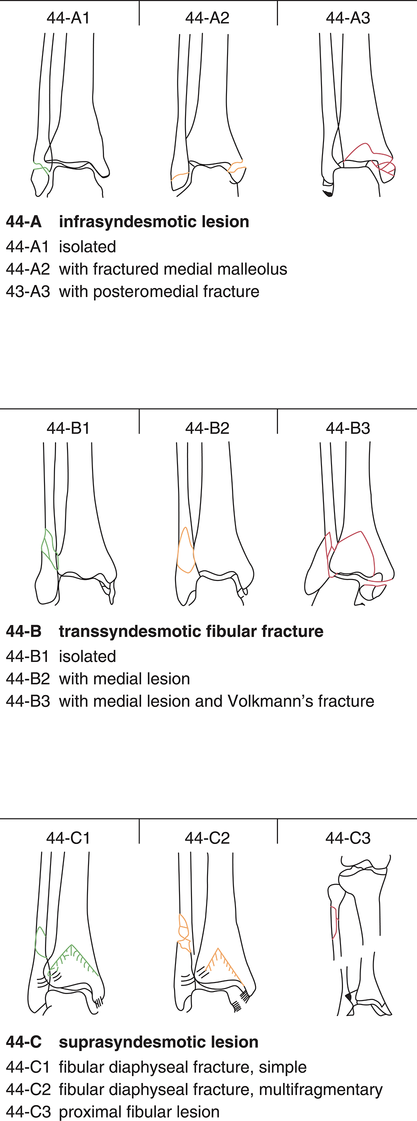 Chapter 21 – Fractures And Dislocations Of The Ankle | Musculoskeletal Key