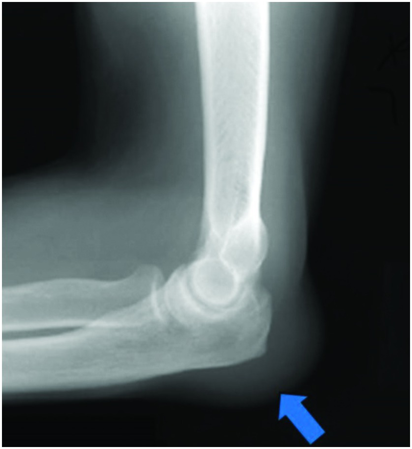 Chapter 2 – Elbow | Musculoskeletal Key