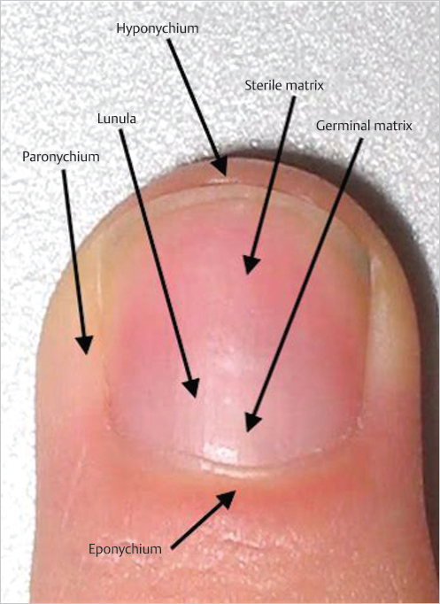 37 The Nail And Finger Pulp | Musculoskeletal Key