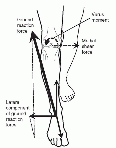 Functional Anatomy And Biomechanics | Musculoskeletal Key