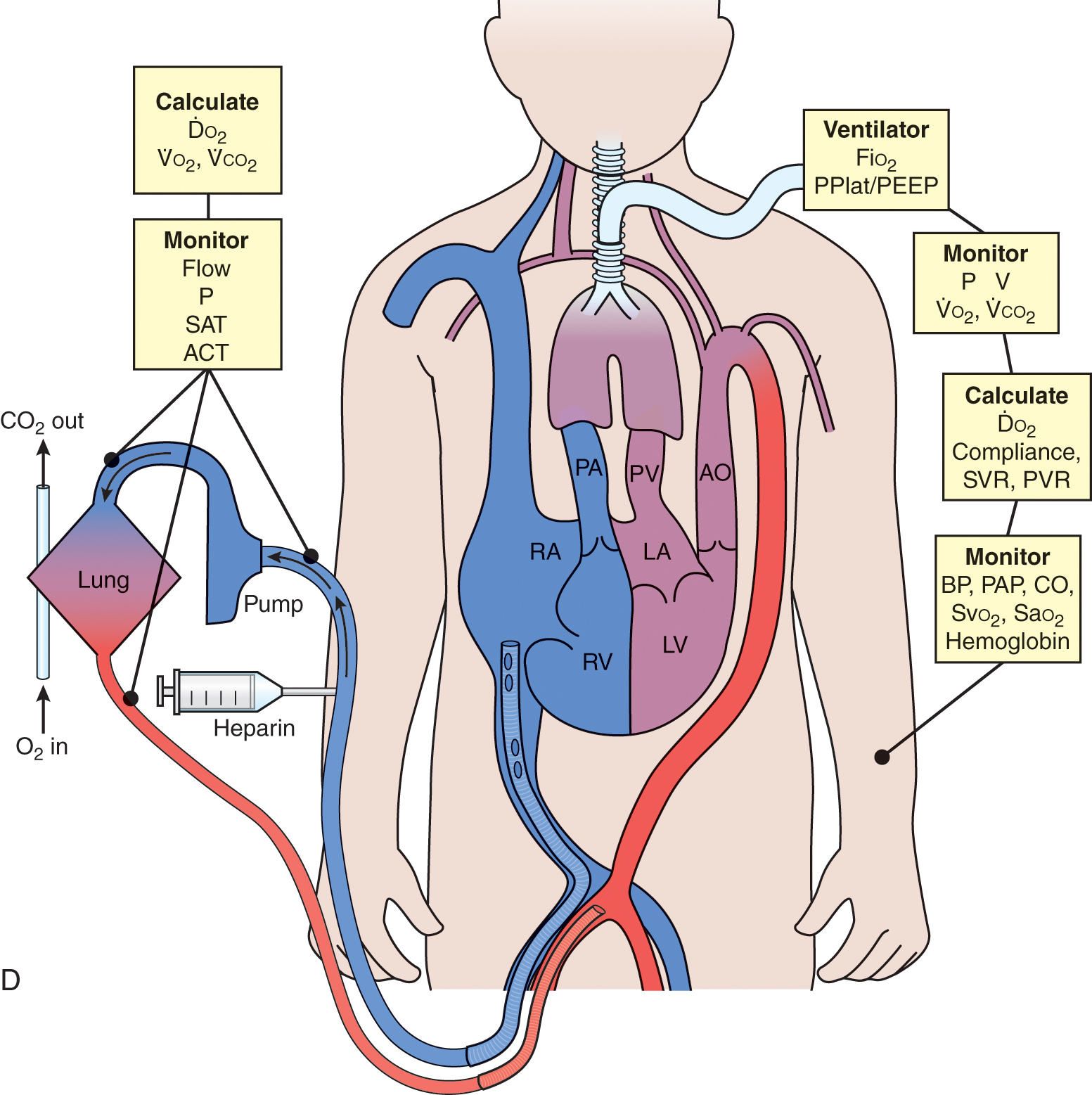 Extracorporeal Life Support | Musculoskeletal Key