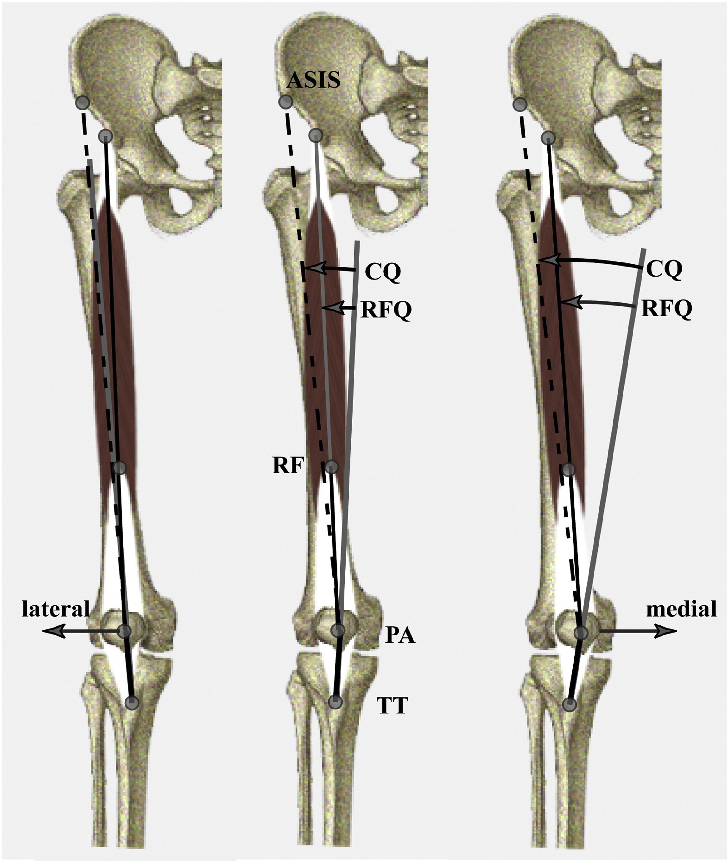 Knee Anatomy And Biomechanics | Musculoskeletal Key