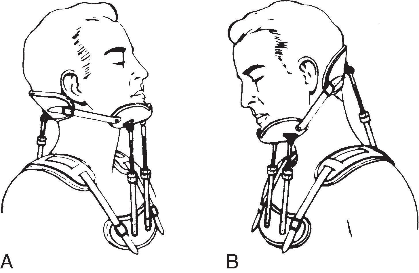 Prosthetics And Orthotics | Musculoskeletal Key