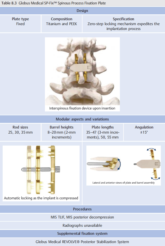 Spinous Process Fixation Systems Musculoskeletal Key