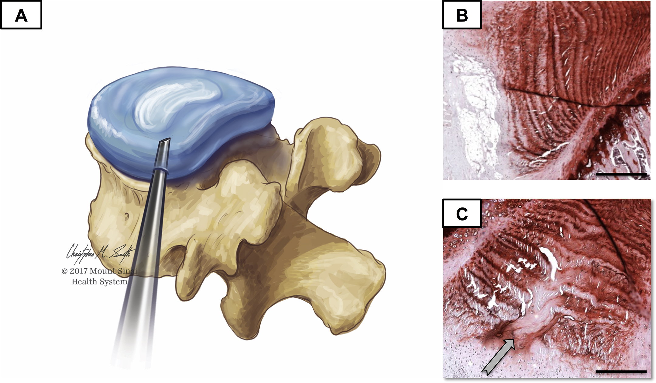 Biomechanical Models To Study Spinal Phenotypes | Musculoskeletal Key