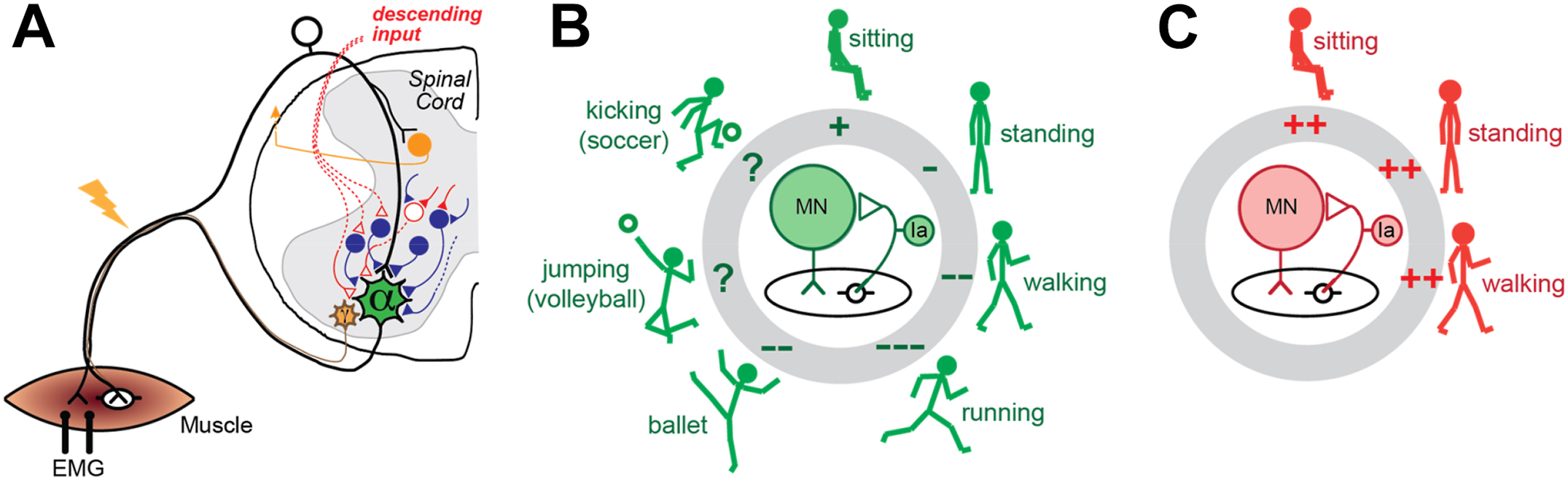 Three schematic diagrams of the spinal stretch reflex and H-reflex show normal task-dependent modulation versus persistent hyperactivity after spinal cord injury.