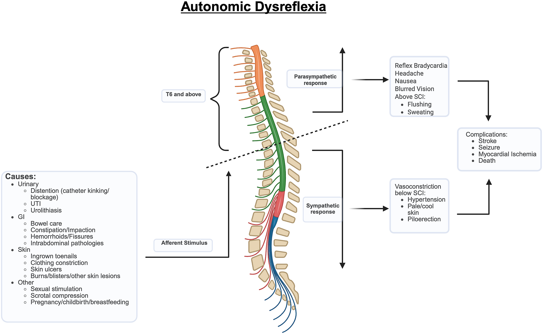 A schematic diagram of the spinal cord with an injury at the T 6 level.