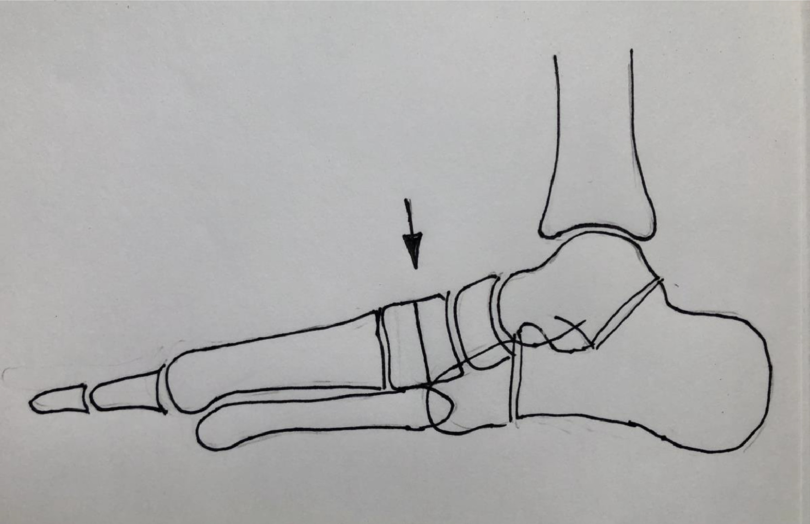 Fig 1A dummy alt text