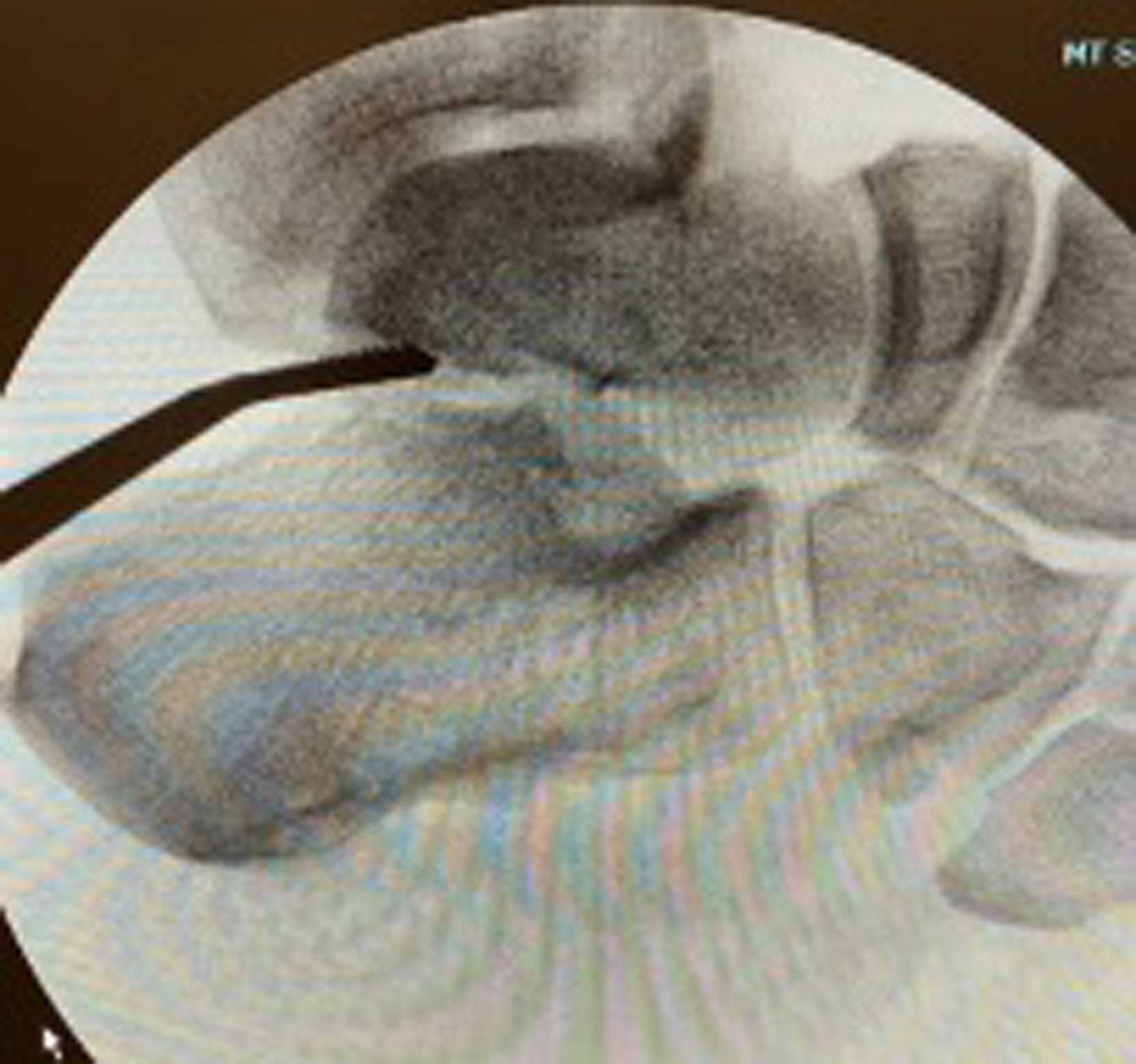 Fig. 1