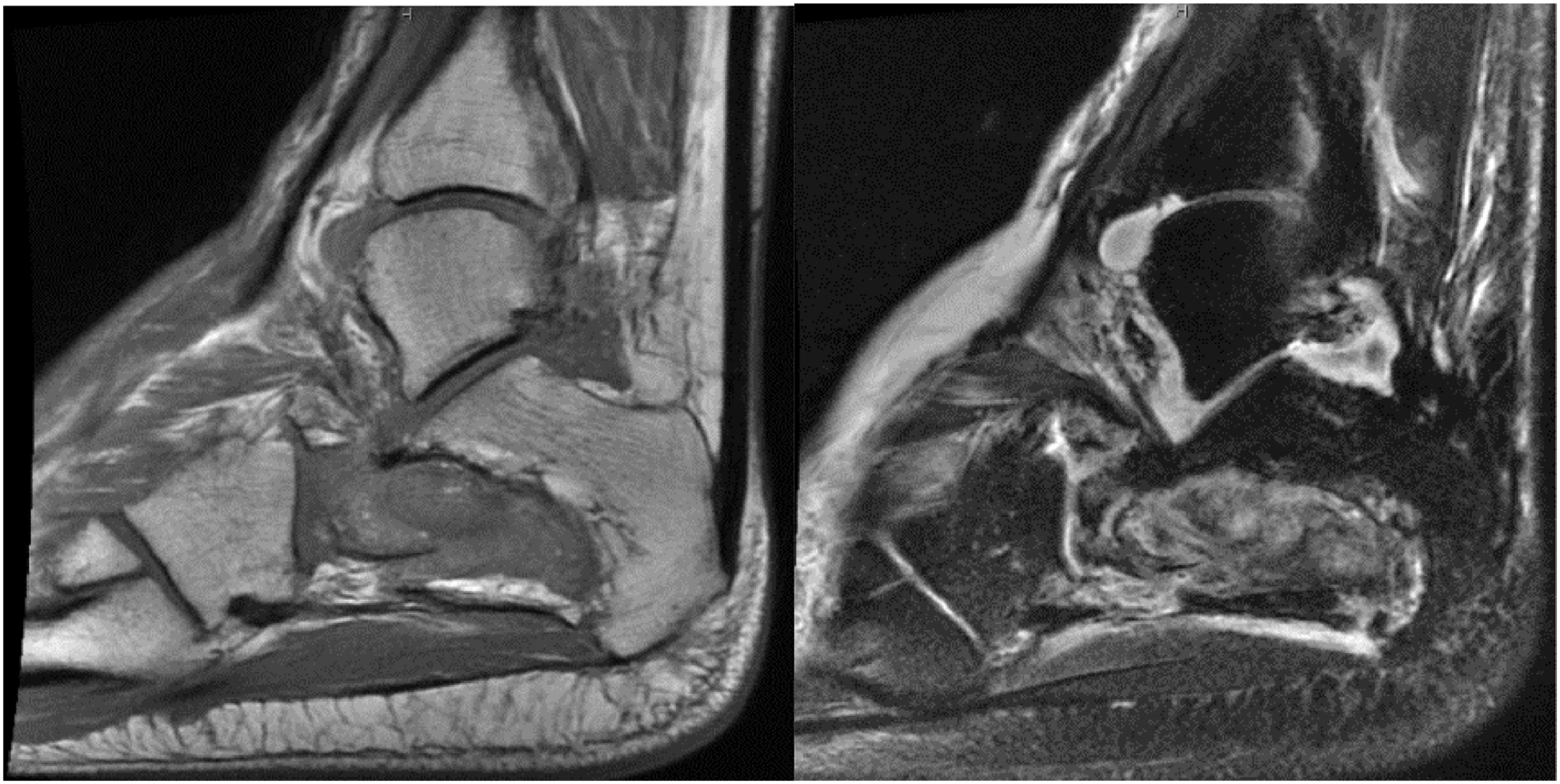Fig 2: