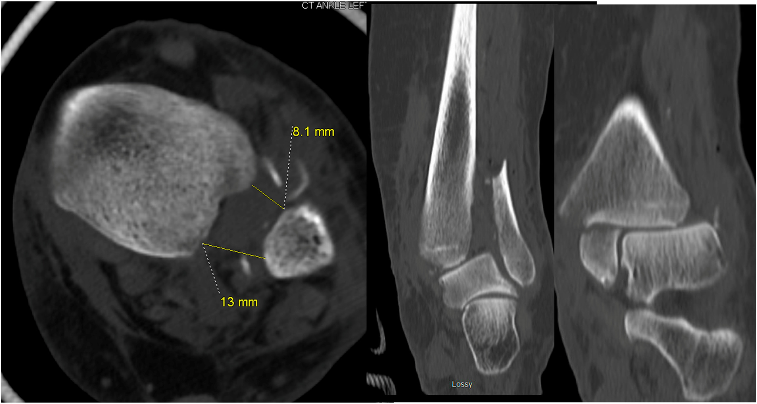 Fig. 2 dummy alt text