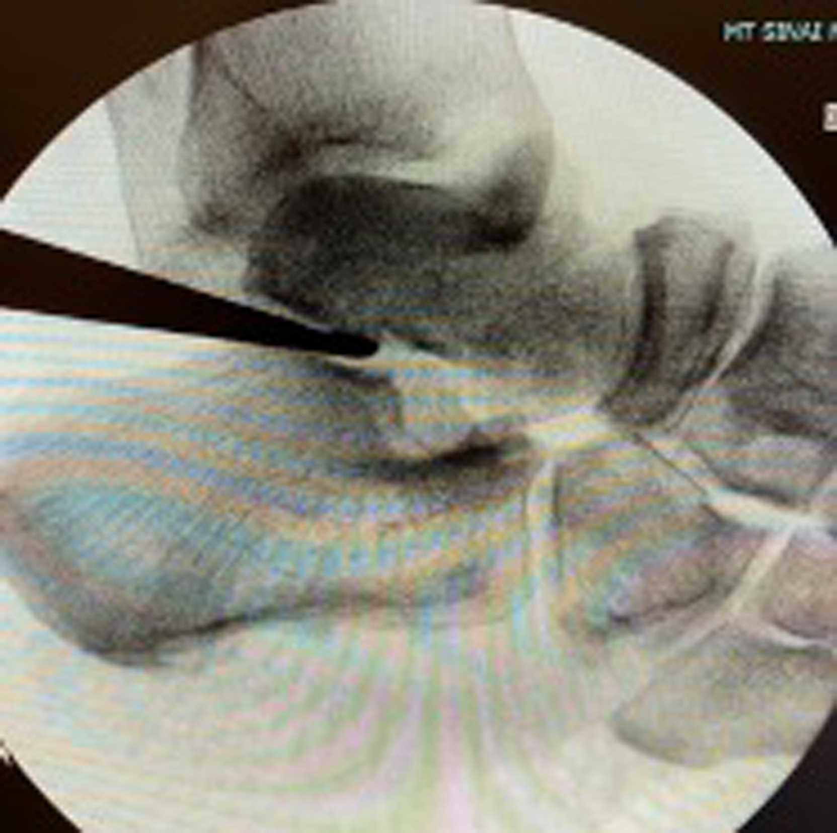 Fig. 2