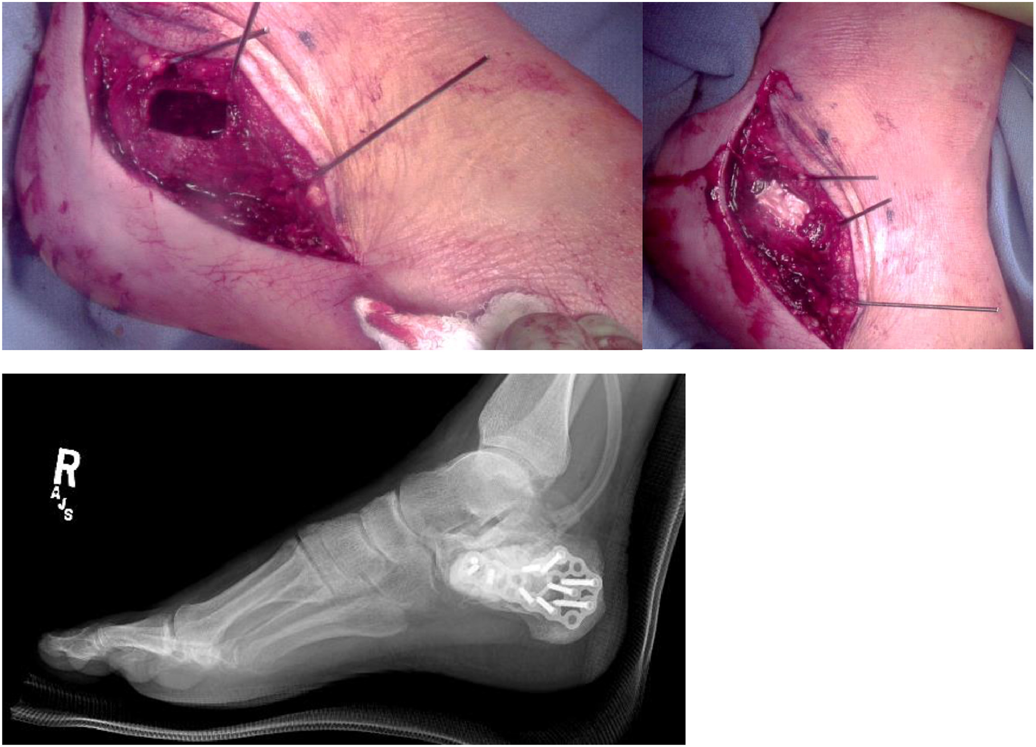 Fig 3: