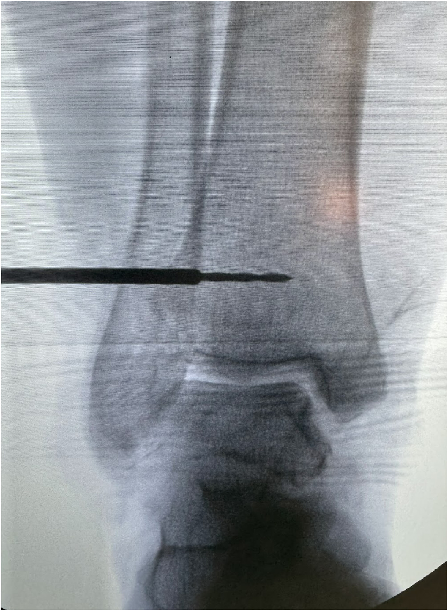 Fig 3: