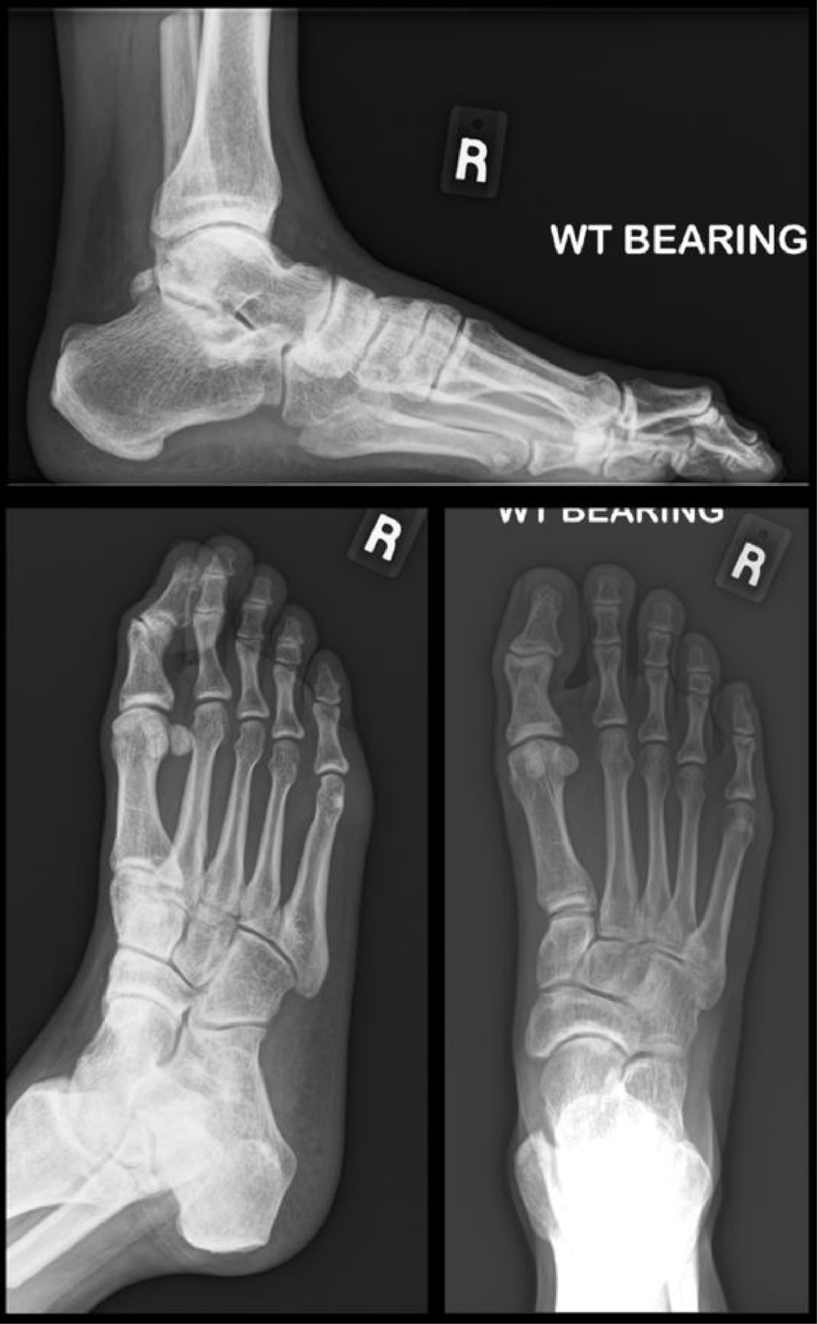 Fig 3: