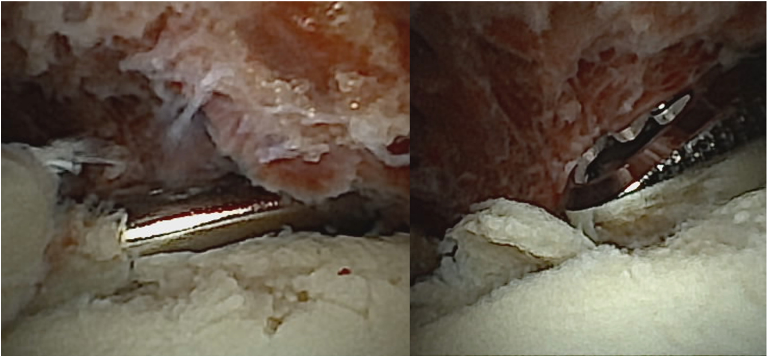 Fig. 3 dummy alt text