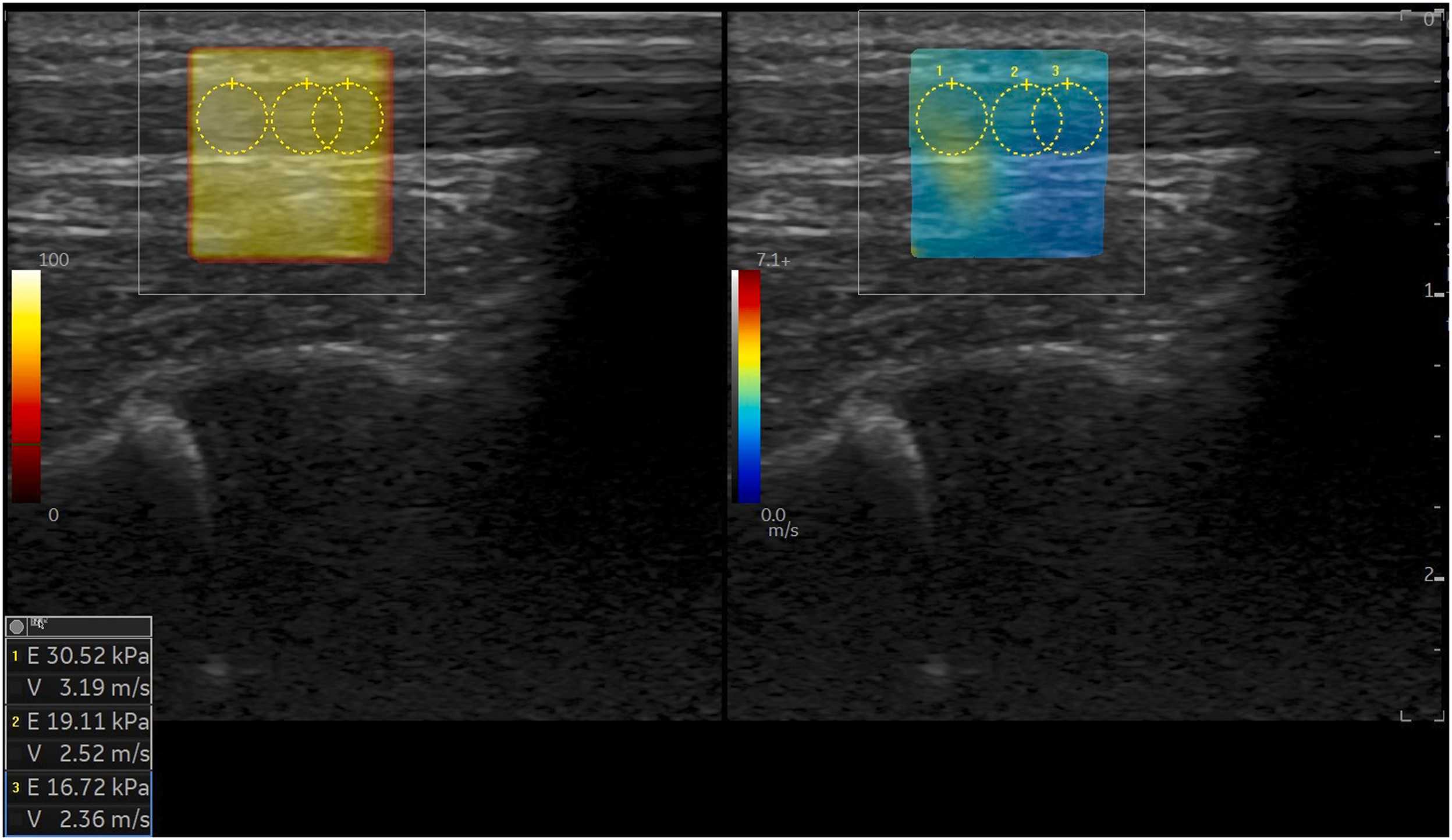 Fig. 3