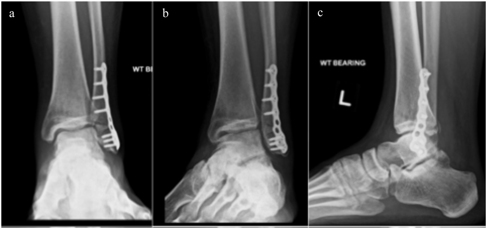 Fig. 3 dummy alt text