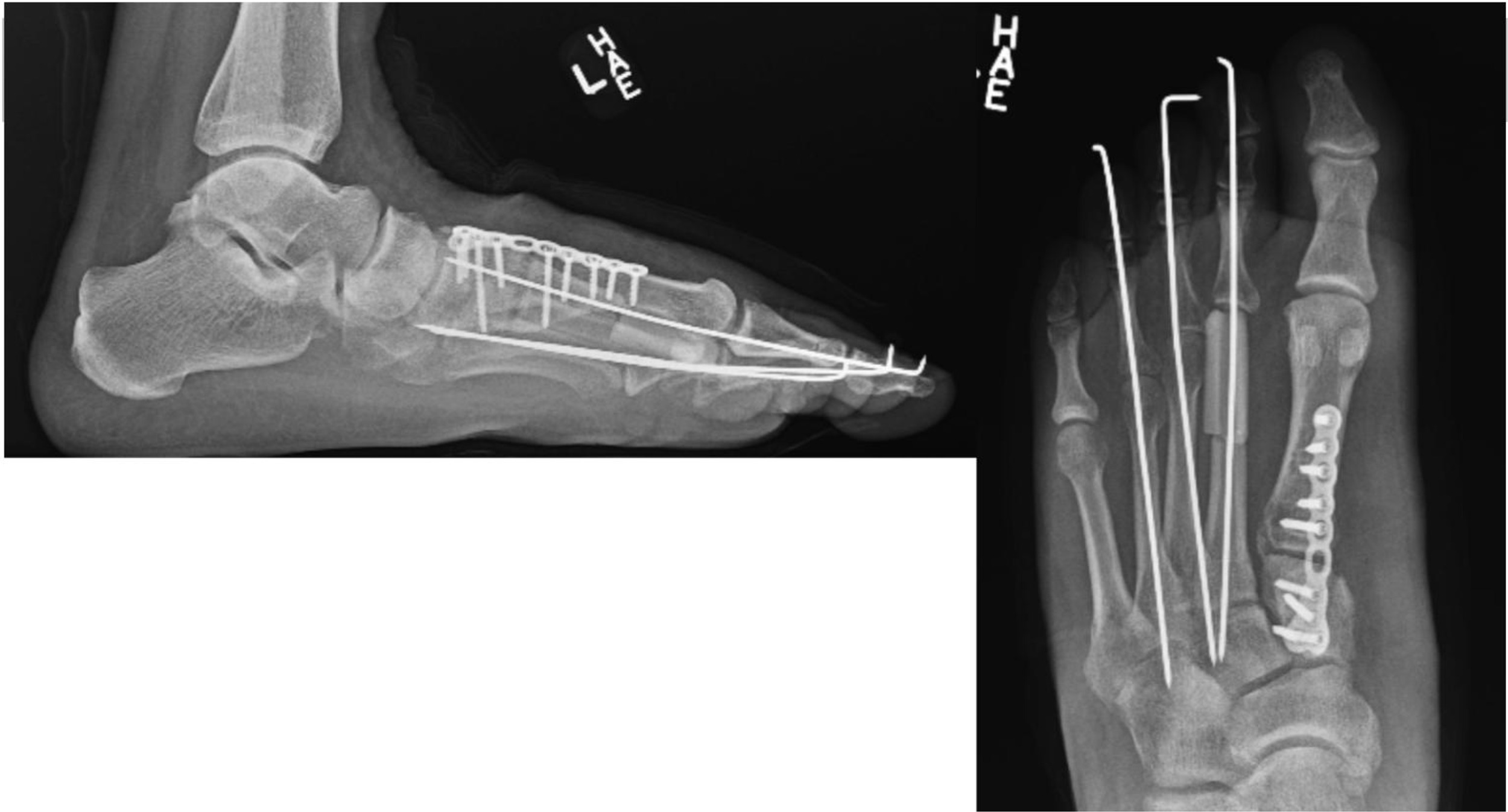 Fig. 3: