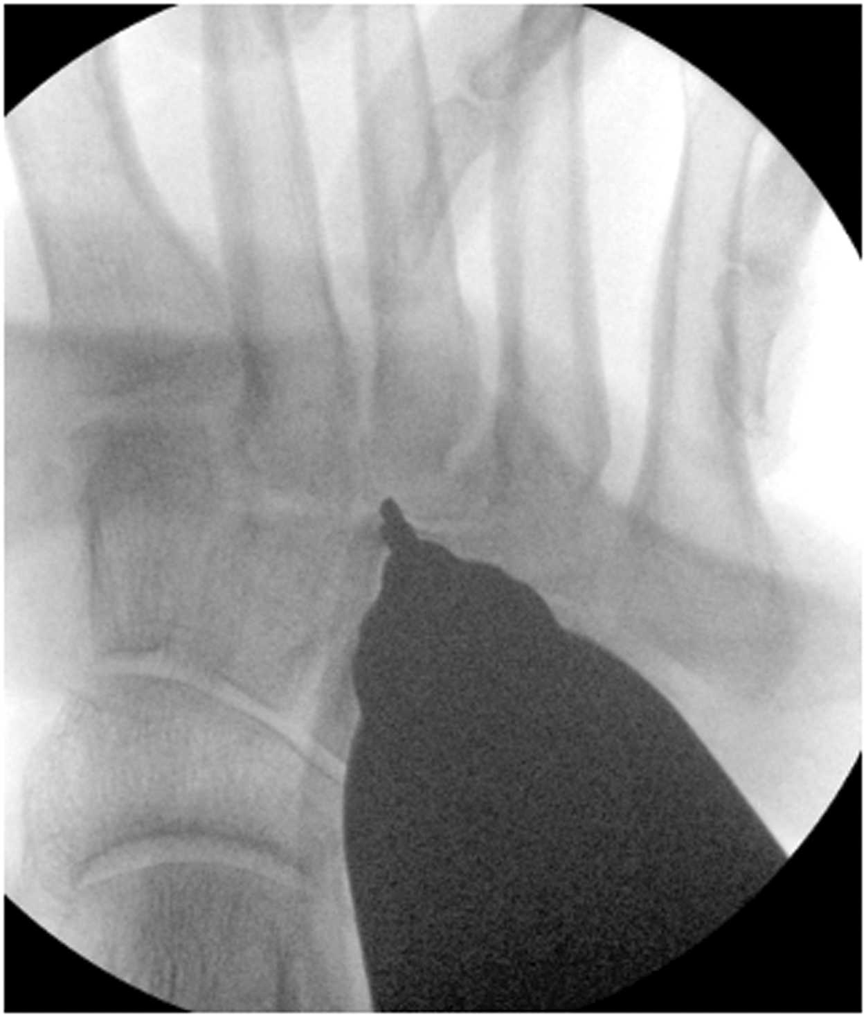 Fig. 4