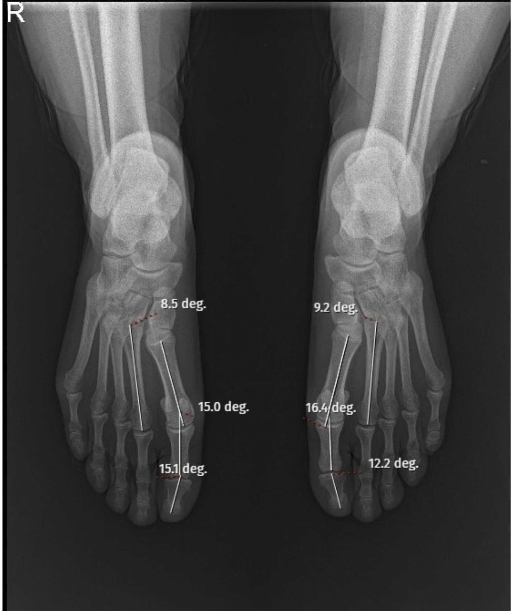 Fig. 4