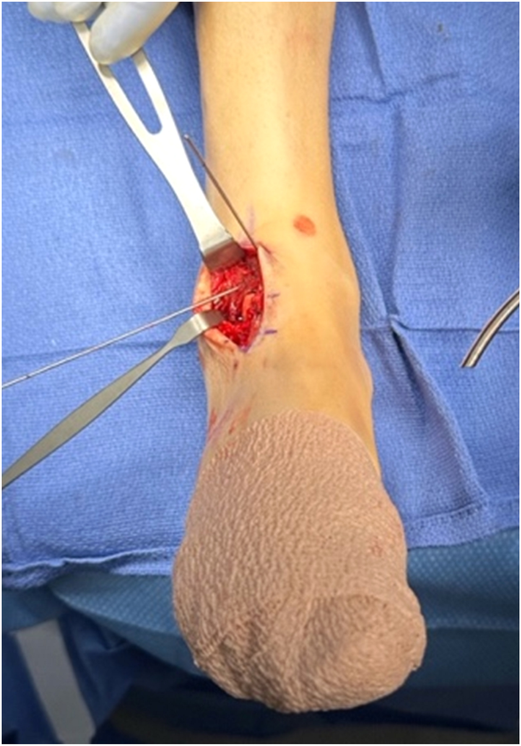 Fig 4 dummy alt text