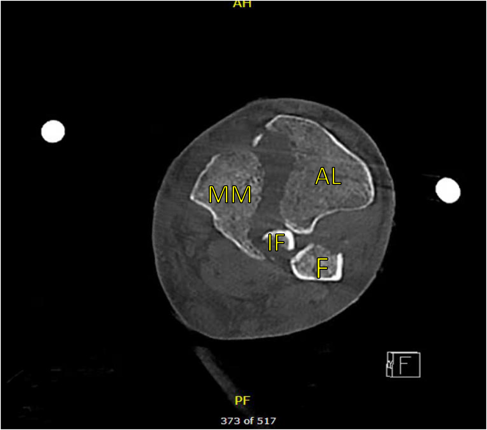 Fig 3A: dummy alt text
