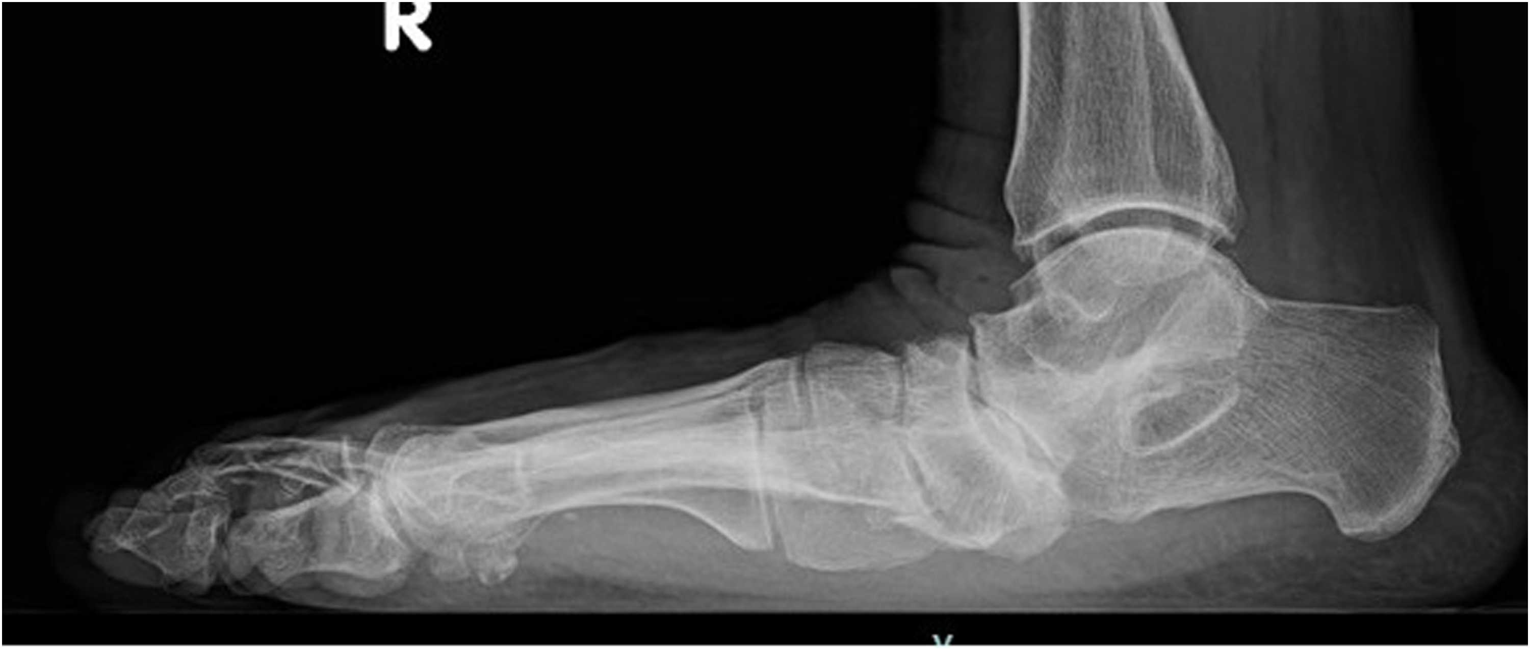 Fig. 5a