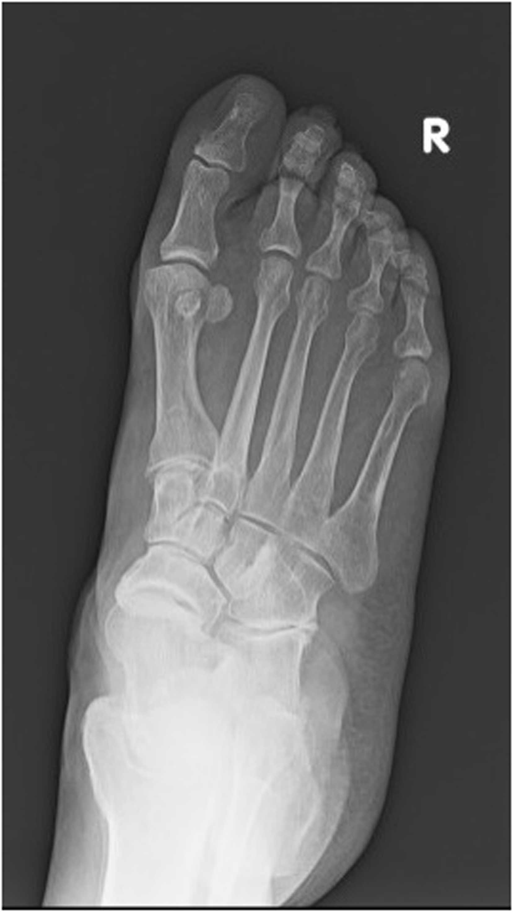 Fig. 5b