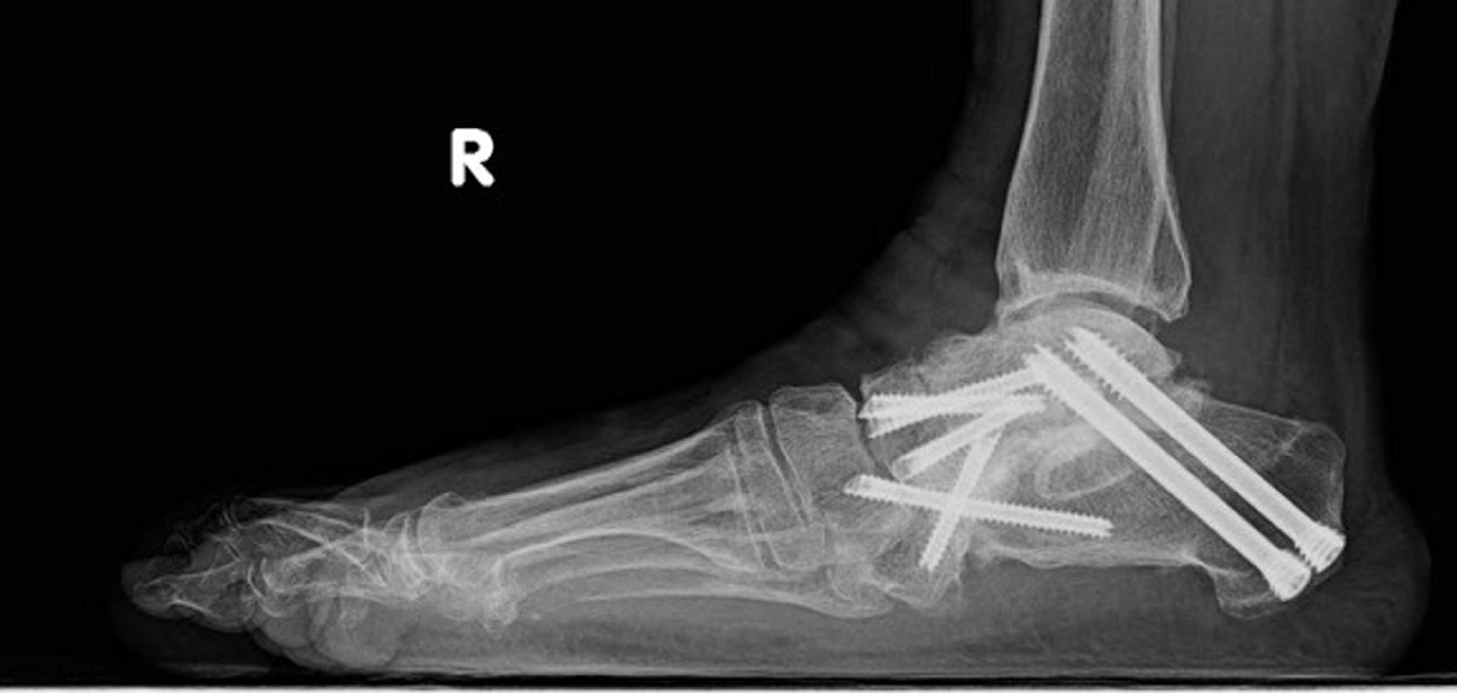 Fig. 5c