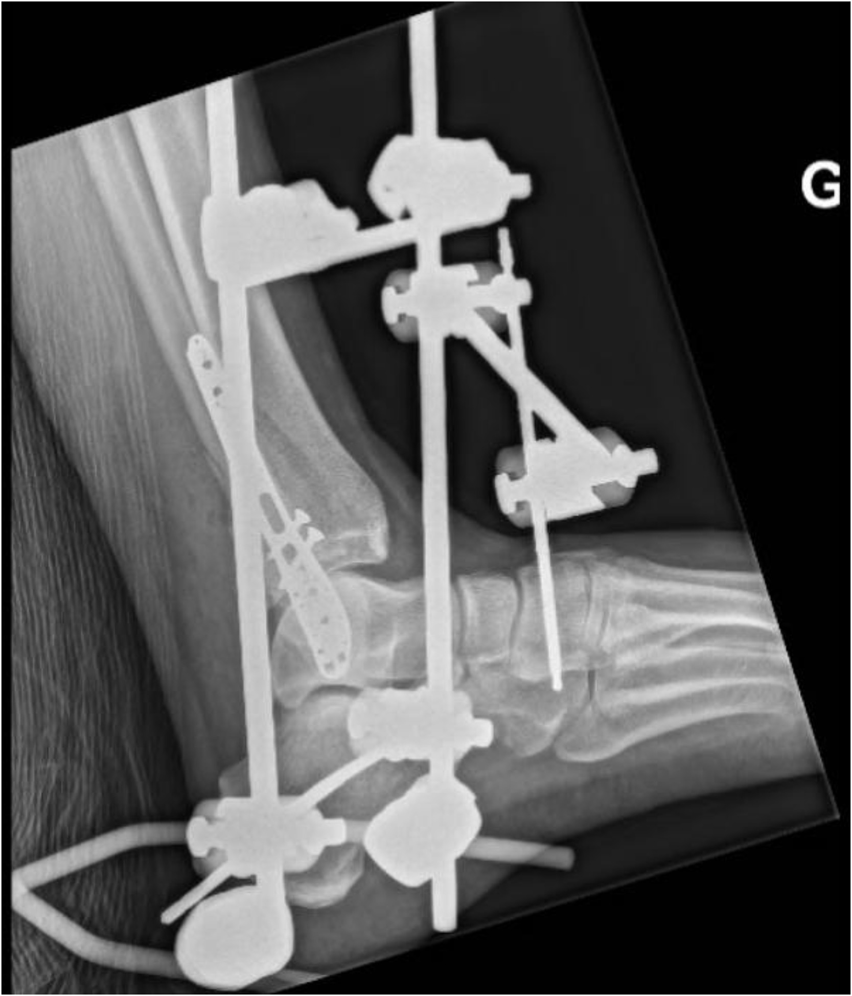 Fig 4A: dummy alt text